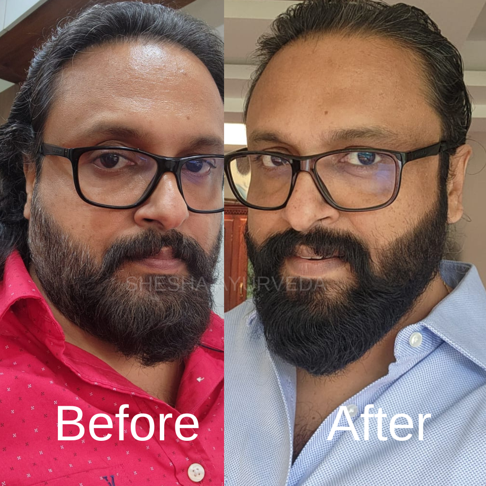 Beared Color Begin Beard Colour – Natural Black 20G – Shesha Ayurveda
